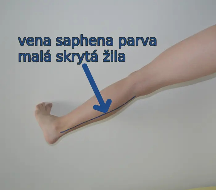 малая подкожная вена
